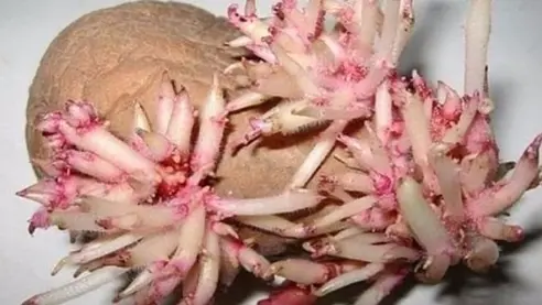 Онези, които страдат от болки в коленете и тазобедрените стави, трябва да прочетат това.