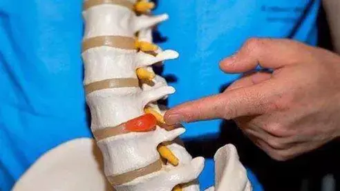 Лекар: „Ако имате болки в ставите, премахнете незабавно този продукт от диетата си.“